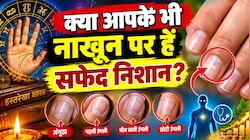 नाखूनों पर दिख रहे हैं सफेद धब्बे? हस्तरेखा शास्त्र में छिपा है इसका बड़ा राज, जानें...