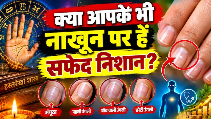 नाखूनों पर दिख रहे हैं सफेद धब्बे? हस्तरेखा शास्त्र में छिपा है इसका बड़ा राज, जानें...