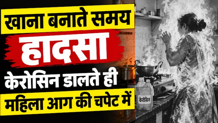 चूल्हे में केरोसिन डालते ही भड़की आग: महिला 90% झुलसी, जलन से हालत हो रही नाजुक