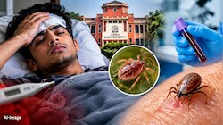 4 दिनों तक बुखार से तपता रहा शरीर: Scrub Typhus से हुई Anna University के छात्र की मौत, कितनी खतरनाक है ये बीमारी?