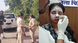 बालोद में पुलिस ड्राइवर की बेटी पर एसिड अटैक, दिनदहाड़े चेहरे पर फेंका तेजाब; आरोपी फरार