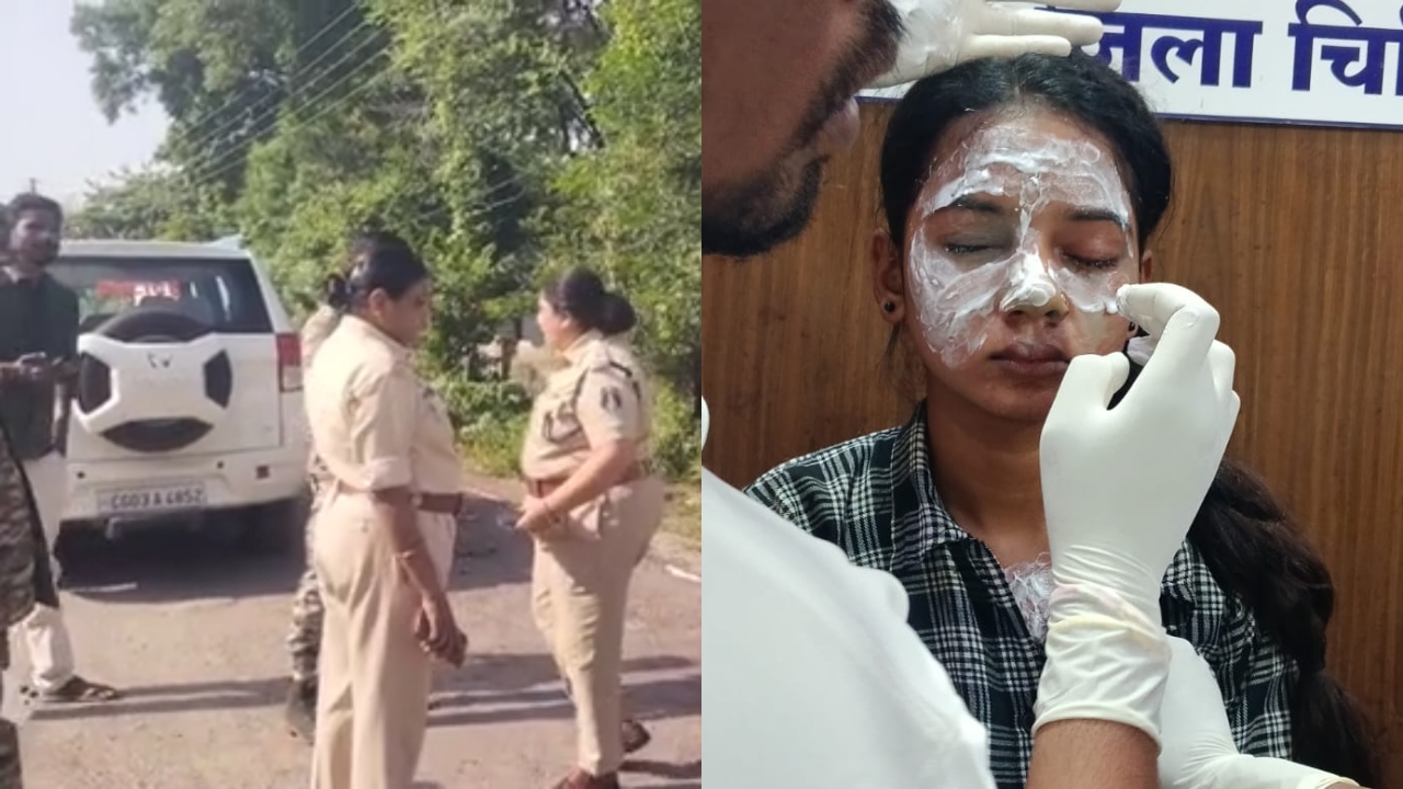 बालोद में पुलिस ड्राइवर की बेटी पर एसिड अटैक, दिनदहाड़े चेहरे पर फेंका तेजाब; आरोपी फरार बालोद में पुलिस ड्राइवर की बेटी पर एसिड अटैक, दिनदहाड़े चेहरे पर फेंका तेजाब; आरोपी फरार