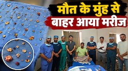 सांसें थाम देने वाली सर्जरी: मौत के मुंह से बाहर आया मरीज, फेफड़ों से निकाले गए 2,000 से ज्यादा सिस्ट्स!