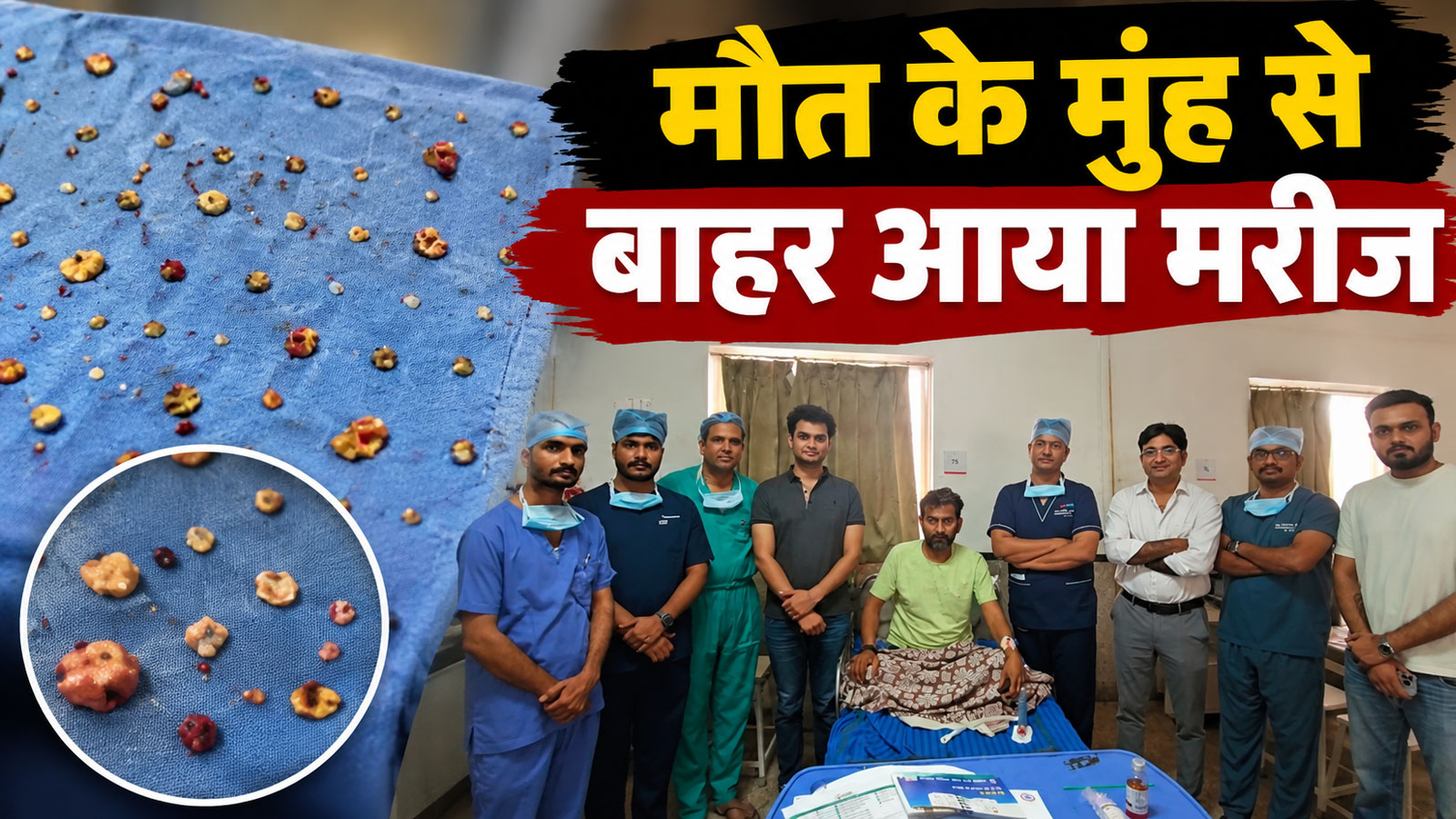 सांसें थाम देने वाली सर्जरी: मौत के मुंह से बाहर आया मरीज, फेफड़ों से निकाले गए 2,000 से ज्यादा सिस्ट्स! सांसें थाम देने वाली सर्जरी: मौत के मुंह से बाहर आया मरीज, फेफड़ों से निकाले गए 2,000 से ज्यादा सिस्ट्स!