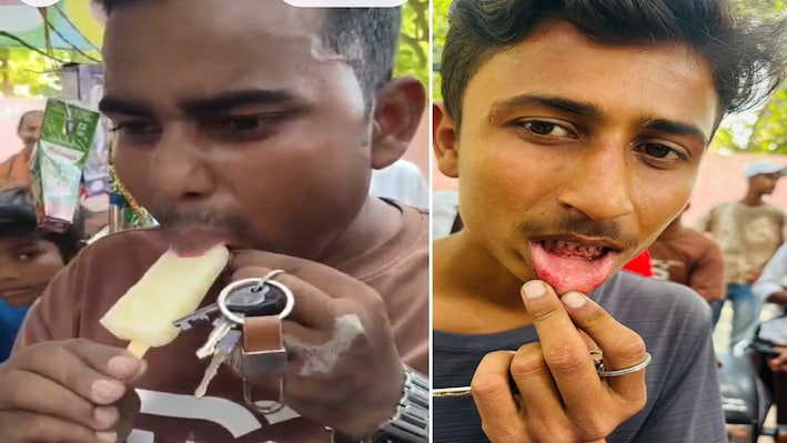 आइसक्रीम नहीं जहर है ये: मोतिहारी में बच्चों ने खाया, तो आपस में सटे होंठ, मुंह से निकलने लगा खून