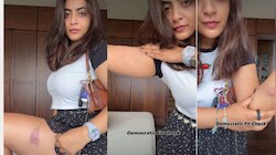 और कितना डराने की कोशिश करोगे: आमिर खान की भांजी जैन मैरी ने पुलिस हिरासत के बाद दिखाए शरीर पर चोट के निशान, वीडियो हुआ वायरल