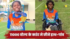 आठ साल की उम्र में लगा 11000 वोल्ट का करंट, बिजली के झटके से खो दिए शरीर के चारों अंग, रोंगटे खड़े कर देगी पायल नाग की कहानी