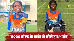 आठ साल की उम्र में लगा 11000 वोल्ट का करंट, बिजली के झटके से खो दिए शरीर के चारों अंग, रोंगटे खड़े कर देगी पायल नाग की कहानी