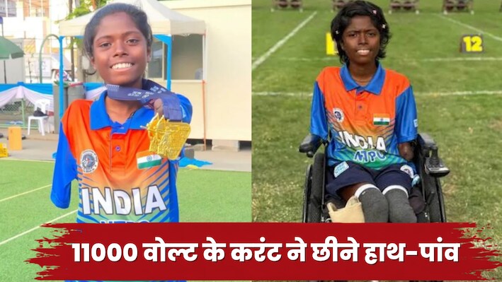 आठ साल की उम्र में लगा 11000 वोल्ट का करंट, बिजली के झटके से खो दिए शरीर के चारों अंग, रोंगटे खड़े कर देगी पायल नाग की कहानी