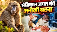 'बेबी फे' की बीमारी: 14 दिन की नवजात को क्‍या समस्‍या थी जो लगाना पड़ा बंदर का दिल, कितने दिन रही जिंदा?