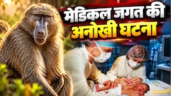 'बेबी फे' की बीमारी: 14 दिन की नवजात को क्‍या समस्‍या थी जो लगाना पड़ा बंदर का दिल, कितने दिन रही जिंदा?