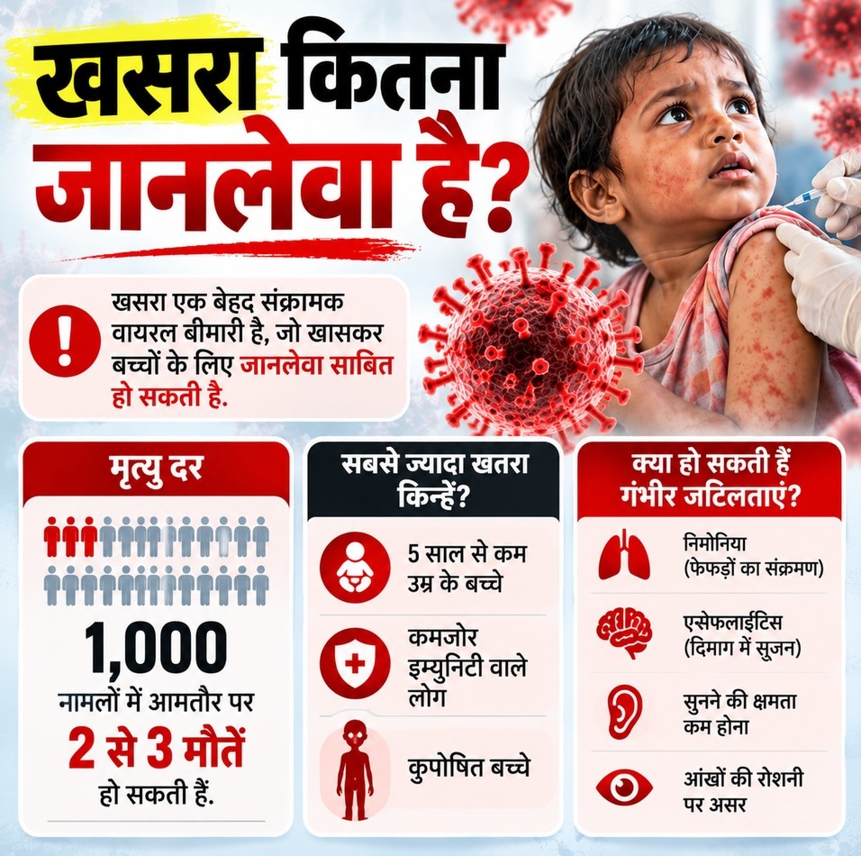 खसरा